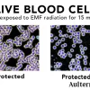 Live blood cells showing damage caused by EMFs and healthy protected cells when using Aulterra EMF Neutralizer products